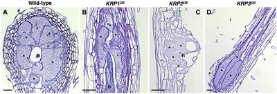 Plant Cyclin-Dependent Kinase Inhibitors of the KRP Family: Potent Inhibitors of Root-Knot Nematode Feeding Sites in Plant Roots